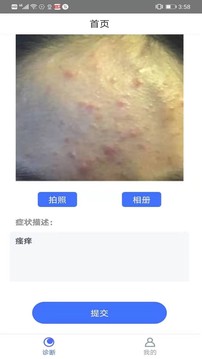 皮肤病诊断选药app